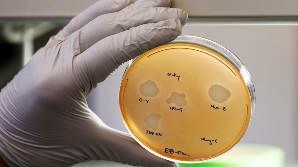 Virus Bacteria Petri Dish